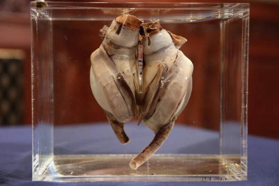 Primer corazón artificial implantado a un humano. Foto: Getty Images